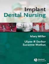 Implant Dental Nursing