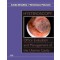 Hysteroscopy: Office Evaluation and Management of the Uterine Cavity - Text with DVD-ROM