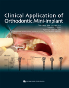 Clinical Application of Orthodontic Mini-Implant