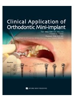 Clinical Application of Orthodontic Mini-Implant