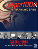 Expert Differential Diagnoses: Brain & Spine