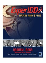 Expert Differential Diagnoses: Brain & Spine