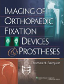 Imaging of Orthopaedic Fixation Devices & Prostheses