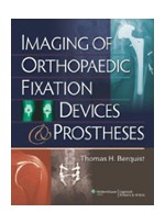 Imaging of Orthopaedic Fixation Devices & Prostheses