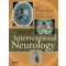 Atlas of Interventional Neurology