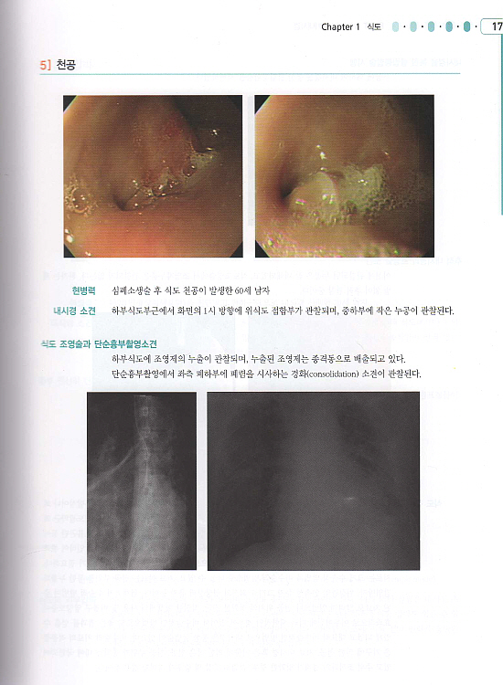 소화기내시경ATLAS-수기및증례
