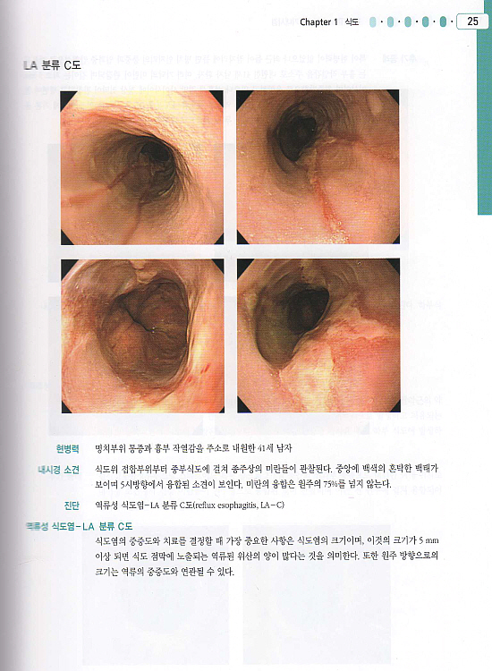 소화기내시경ATLAS-수기및증례