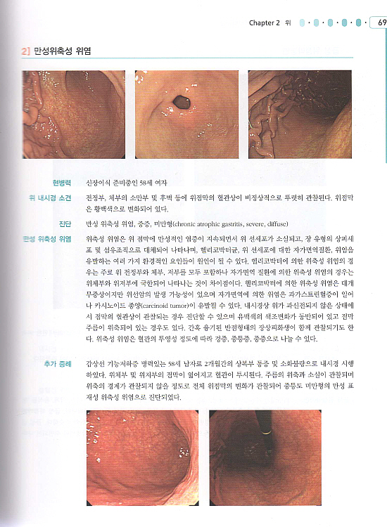 소화기내시경ATLAS-수기및증례