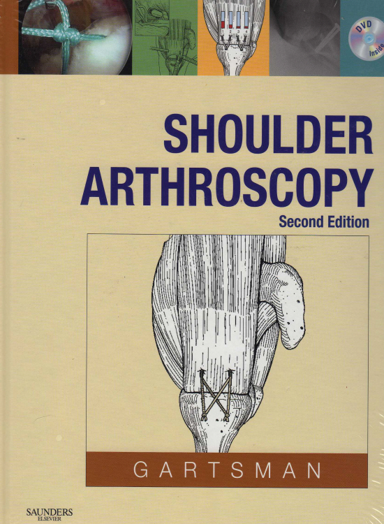 Shoulder Arthroscopy,2/e