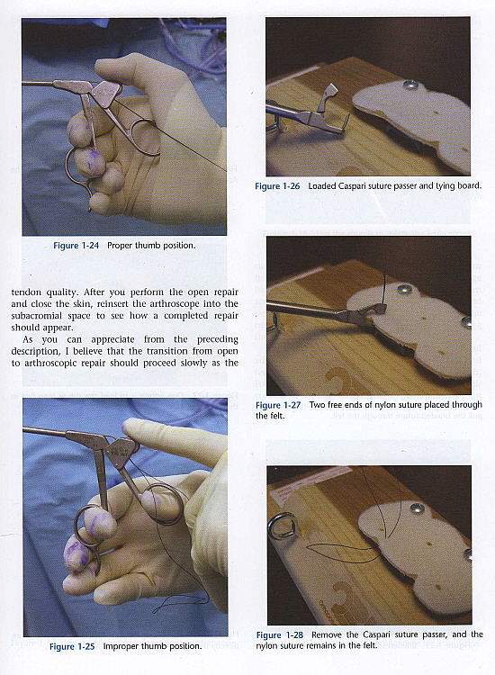 Shoulder Arthroscopy,2/e