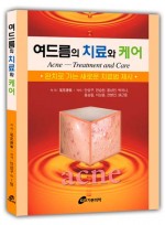 여드름의 치료와 케어-완치로 가는 새로운 치료법 제시