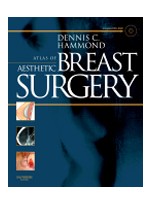 Atlas of Aesthetic Breast Surgery