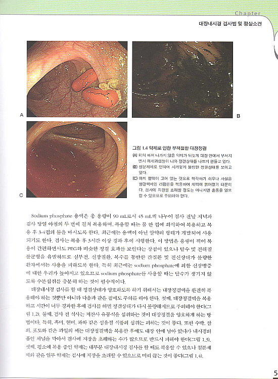 대장내시경 진단및치료 (둘째판)