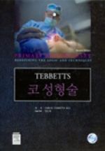 코성형술(TEBBETTS)