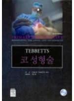 코성형술(TEBBETTS)