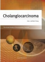 Cholangiocarcinoma