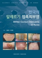 한국의 알레르기 접촉피부염