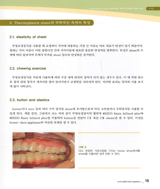 RASA의 손쉬운 제작과 적용 (resin added sheet appliance)