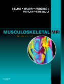Musculoskeletal MRI, 2/e