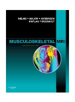 Musculoskeletal MRI, 2/e