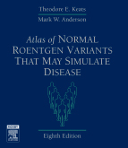 Atlas of Normal Roentgen Variants That May Simulate Disease,8/e