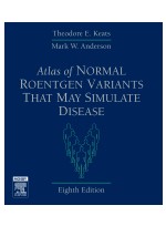 Atlas of Normal Roentgen Variants That May Simulate Disease,8/e