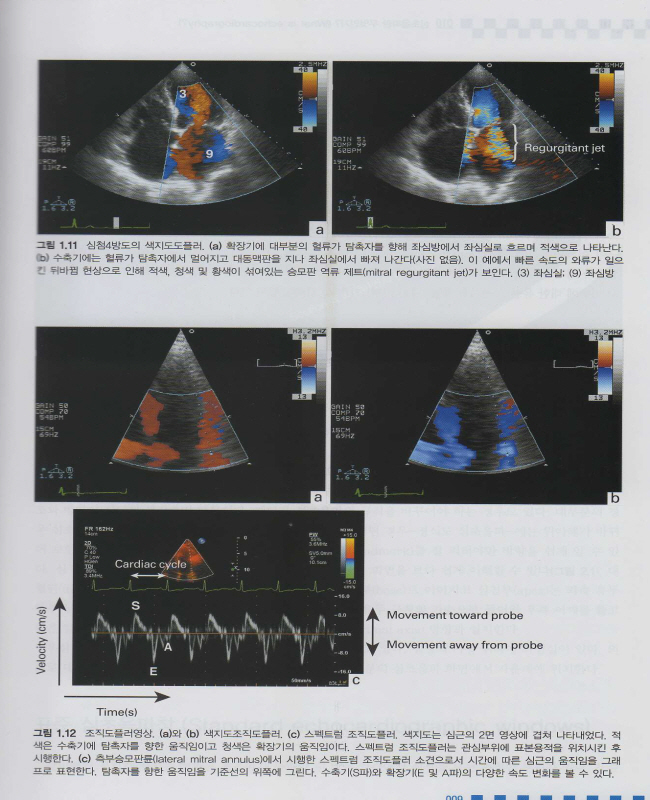 임상 심초음파 - 동영상과 함께 배우는 (동영상 CD포함)