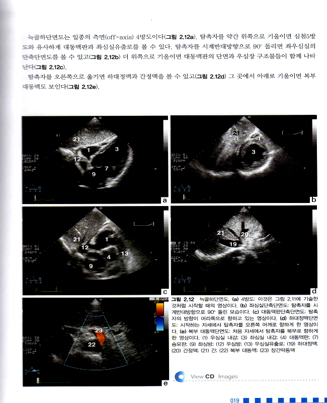 임상 심초음파 - 동영상과 함께 배우는 (동영상 CD포함)