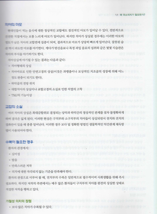 이해하기 쉬운 국소의치 디자인