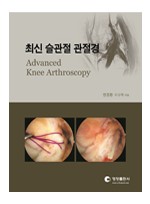 최신 슬관절 관절경 (Advanced Knee Arthroscopy)