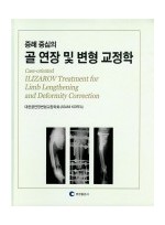 골 연장 및 변형 교정학 -증례중심의