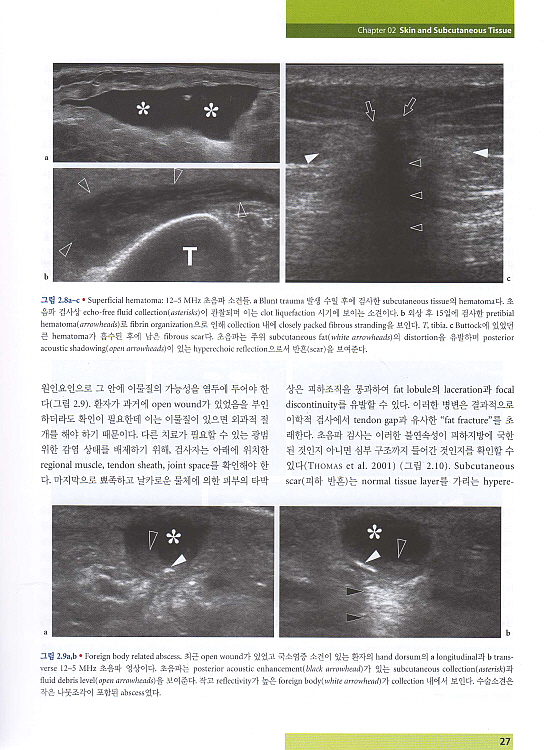 근골격계초음파-Ultrasound of the Musculoskeletal System