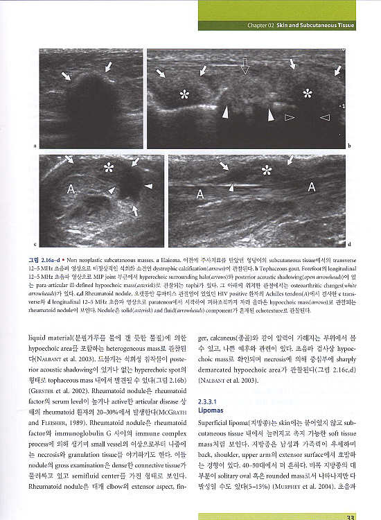 근골격계초음파-Ultrasound of the Musculoskeletal System