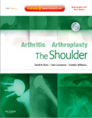Arthritis & Arthroplasty:The Shoulder: Expert Consult - Online Print & DVD