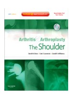 Arthritis & Arthroplasty:The Shoulder: Expert Consult - Online Print & DVD