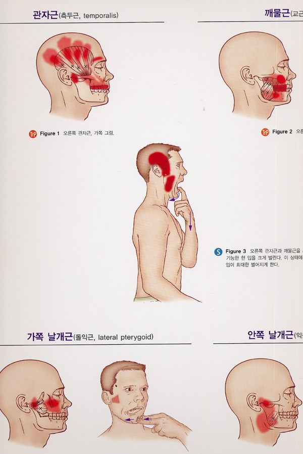 근근막통증증후군의 통증유발점과 스트레칭을 위한차트