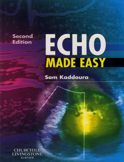 Echo Made Easy, 2/e