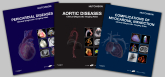 Aortic Diseases; Pericardial Diseases and Complications of Myocardial Infarction Package