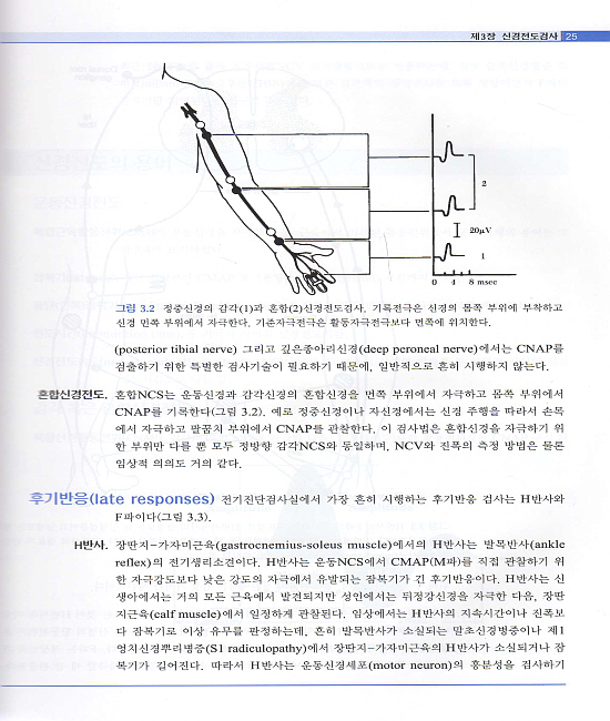 임상근전도학 (CD1) [양장본]