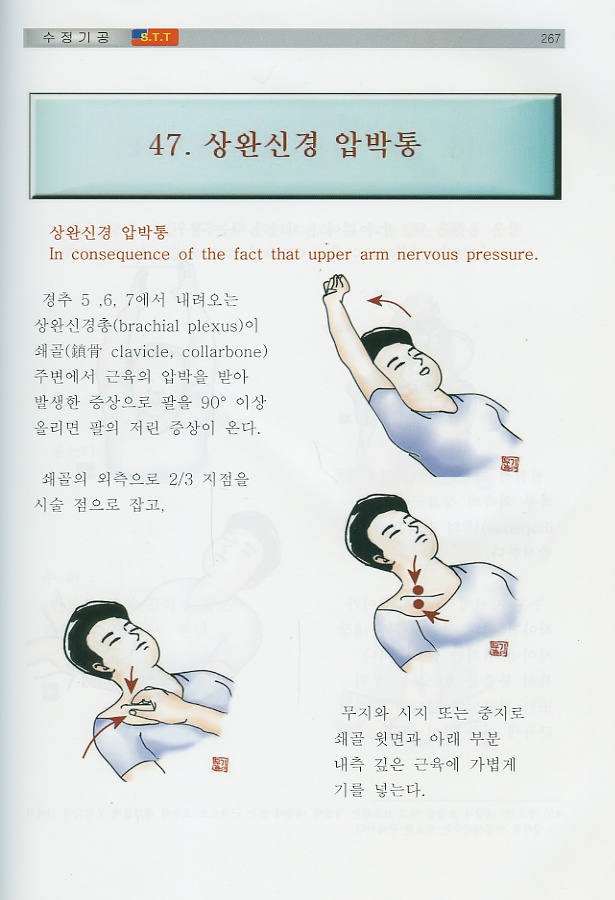 통증치료의 황제 수정기공 stt (종합응용편)