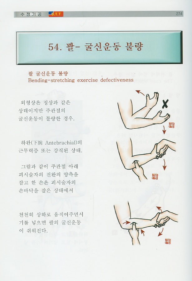 통증치료의 황제 수정기공 stt (종합응용편)