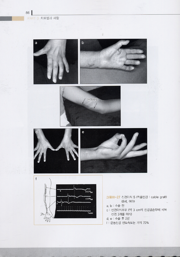 말초신경의 임상