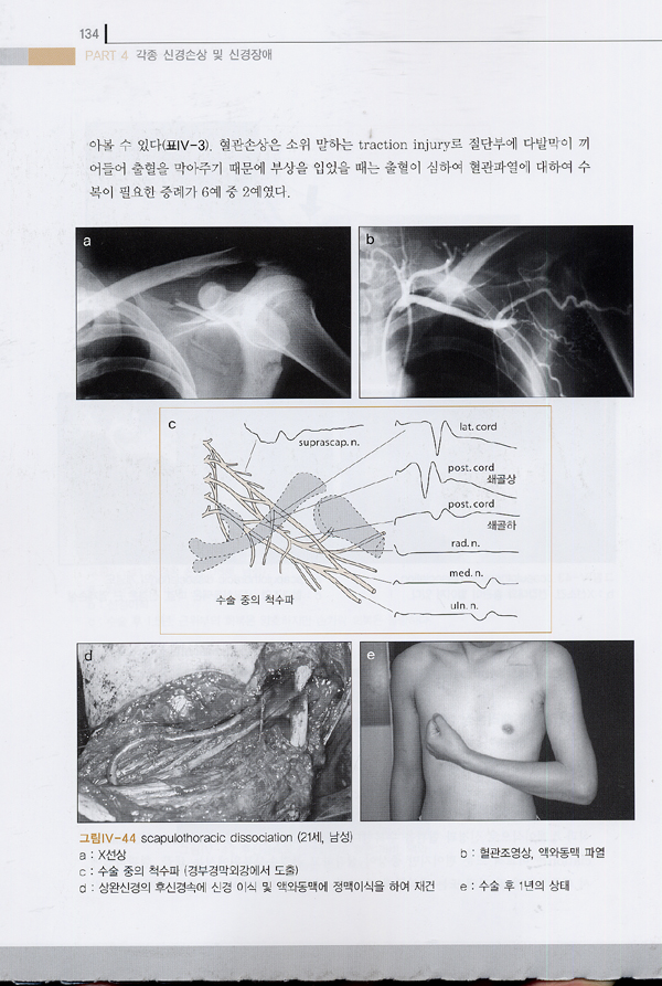 말초신경의 임상