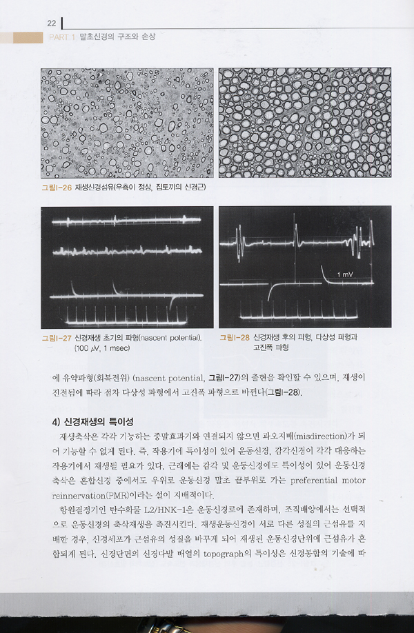 말초신경의 임상