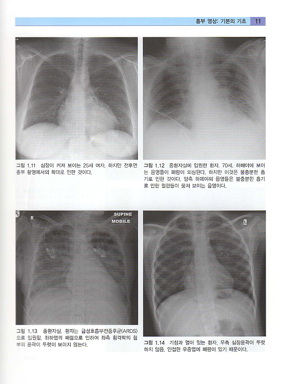 흉부 X선 실전가이드 - The Chest X-Ray : A survival guide