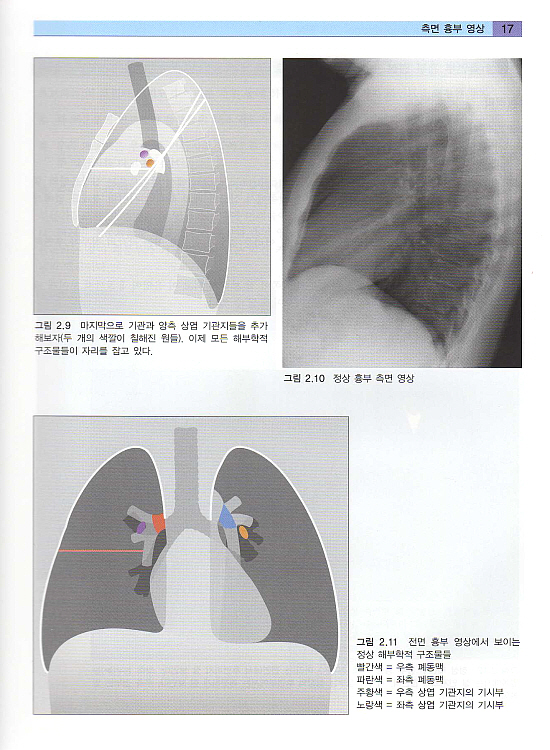 흉부 X선 실전가이드 - The Chest X-Ray : A survival guide