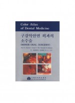 구강악안면 외과의 소수술-Minor Oral Surgery