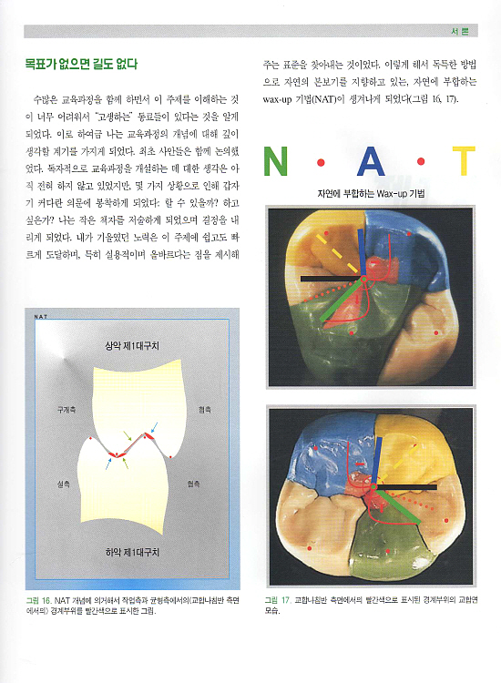 NAT 자연에 부합하는 Wax-up 기법 (Vol.II 구치부)