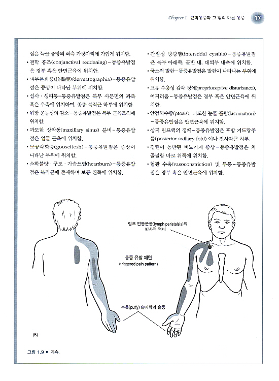 통증유발점의 도수치료