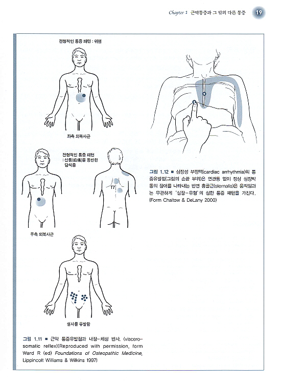 통증유발점의 도수치료